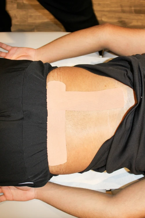 Close-up of a person’s lower back with large medical adhesive bandages/dressings across the skin, suggesting post-surgical care.