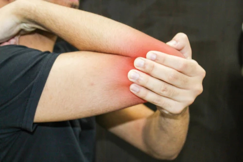 Close-up of a reddened, inflamed elbow being held by the other arm, suggesting elbow pain or injury.